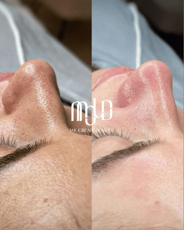 Why OFWs Choose Mold Manila for Safe, Time‑Efficient Aesthetic Care During Philippine Visits